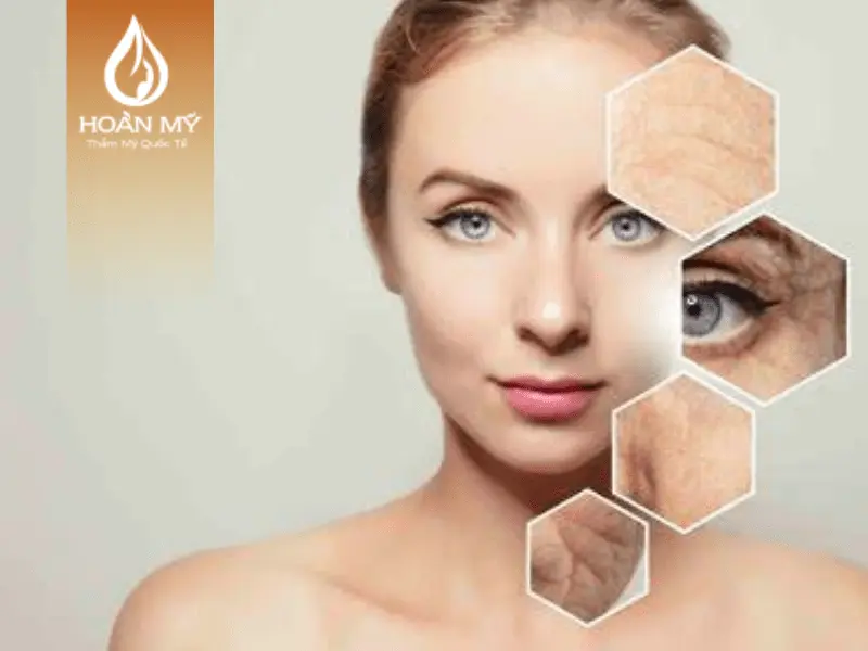 Da bị lão hóa các vùng trên mặt