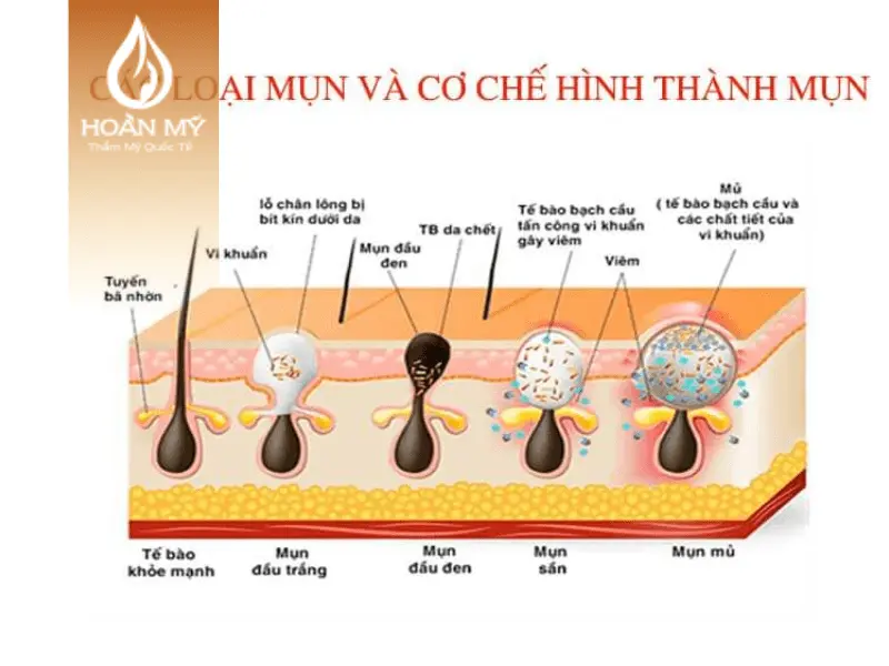 Chuyên gia tại các lớp học chăm sóc da cơ bản sẽ có phương pháp điều trị thích hợp