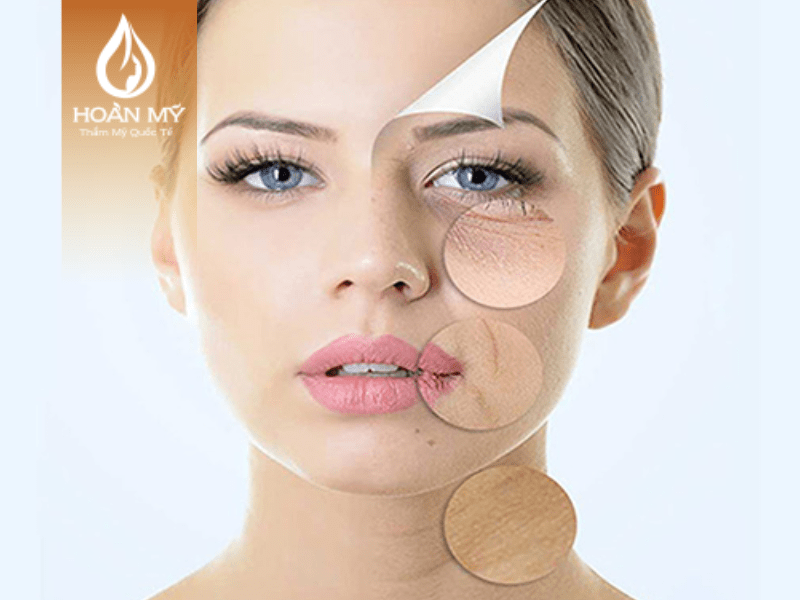 Công nghệ trẻ hóa làn da