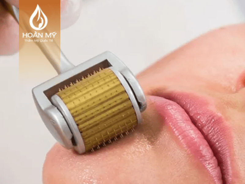 khóa học nghề spa chăm sóc da sẽ hướng dẫn cách điều trị chi tiết