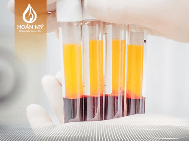 Phương pháp cấy huyết tương giàu tiểu cầu giúp trẻ hóa làn da