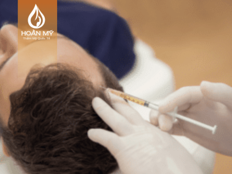 Phương pháp hiệu quả trong việc điều trị hói đầu và rụng tóc