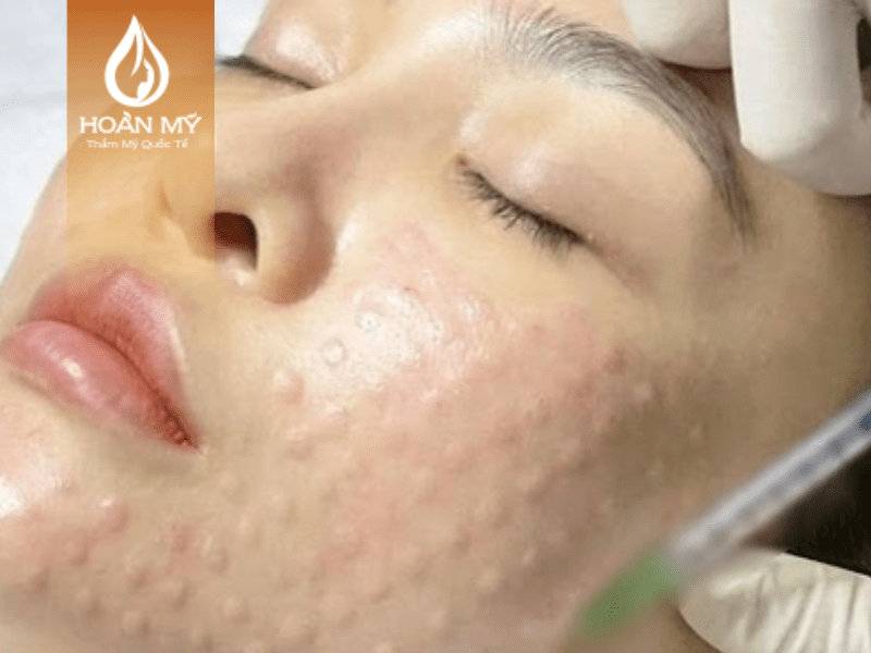 Liệu pháp tại khóa đào tạo chăm sóc da mặt giúp làm sáng và giảm nếp nhăn cho làn da