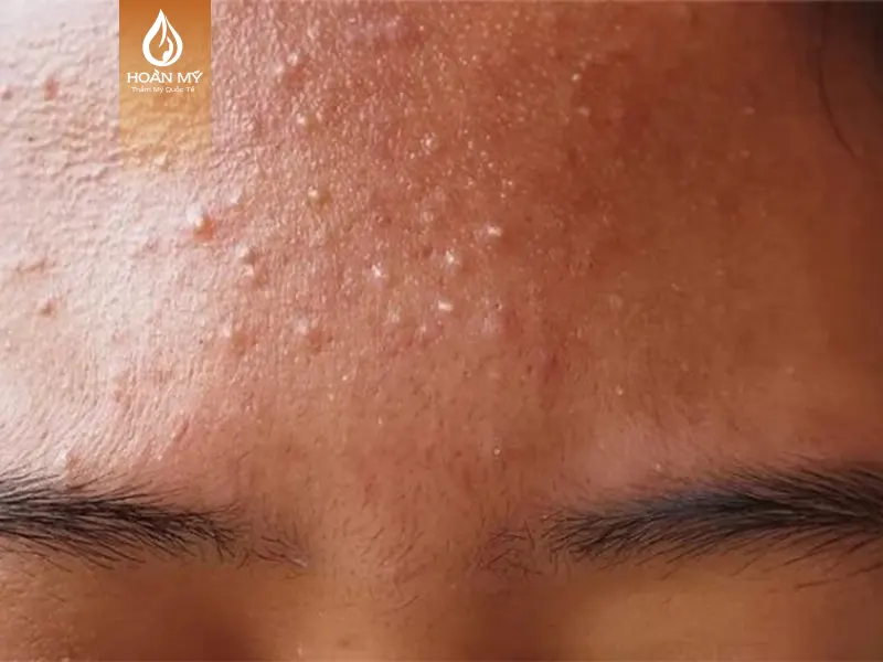 khóa học chăm sóc da chuyên sâu