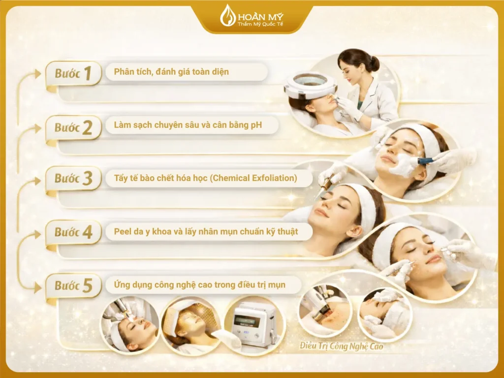 phac-do-dieu-tri-mun-trung-ca-chuyen-sau-tai-spa (1)