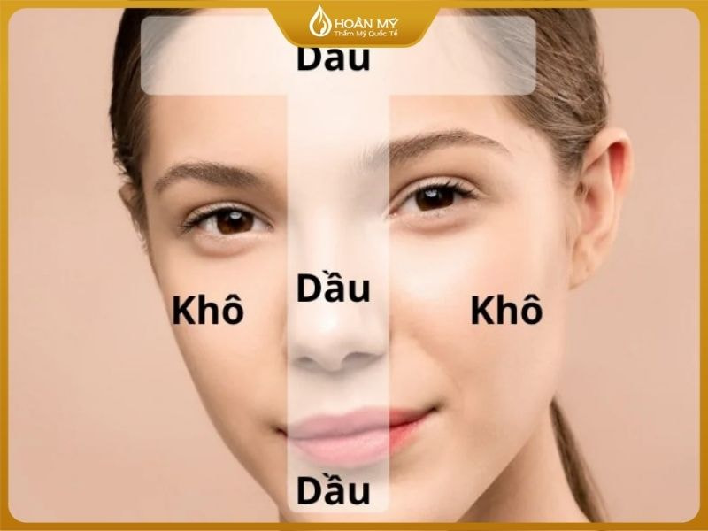 Da hỗn hợp là sự kết hợp giữa da dầu và da khô