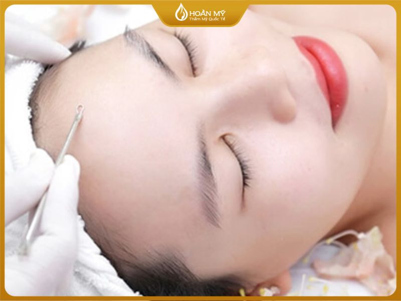 Học viên sẽ được thực hành lấy nhân mụn đúng kỹ thuật trong khóa học chăm sóc da mặt cơ bản