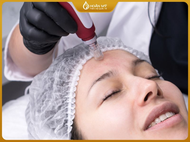 Trong khóa học spa Chăm sóc da chuyên nghiệp, kỹ thuật vi kim tảo biển và vi kim sinh học giúp học viên nắm vững phương pháp tái tạo da hiện đại