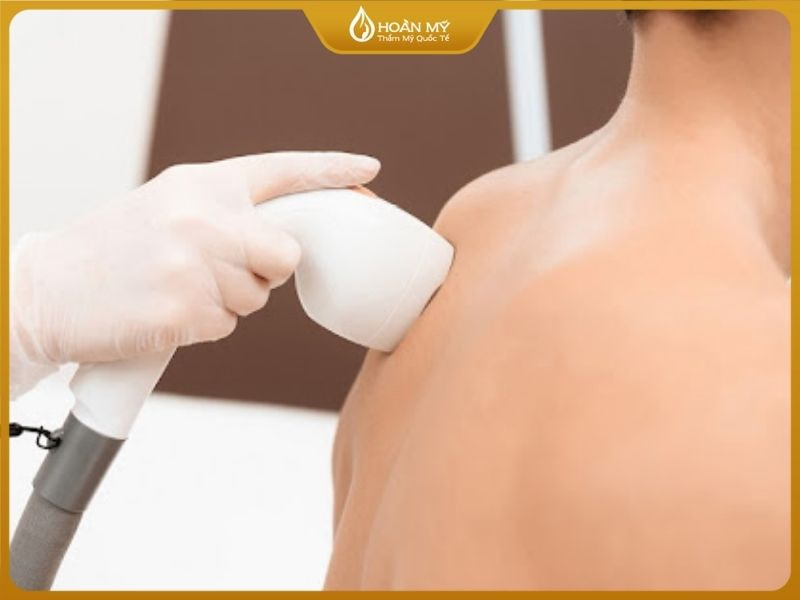 Dịch vụ triệt lông và tẩy tế bào chết