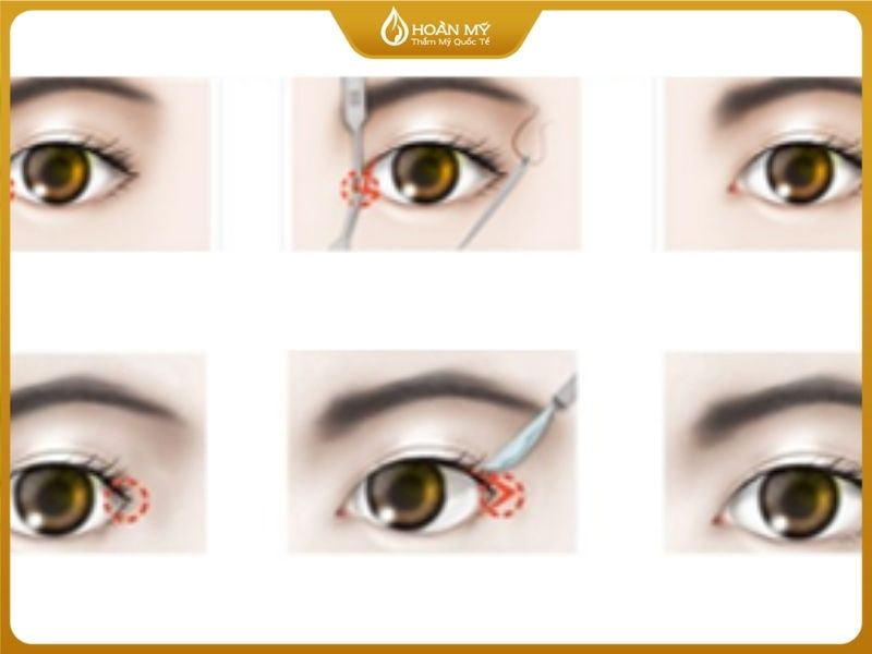Bản đồ Contouring và kỹ thuật Foxy eyes giúp thay đổi cấu trúc gương mặt