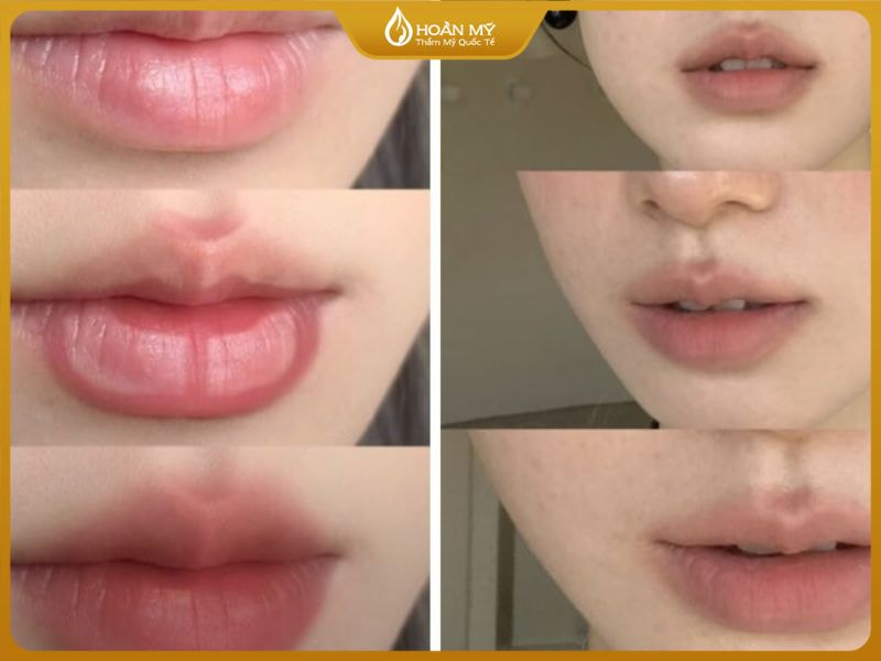 Đôi môi căng mọng với hiệu ứng Blurred lips là điểm nhấn hoàn hảo cho layout makeup tone cam.